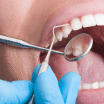 Dental Check-Ups vs Dental Cleans