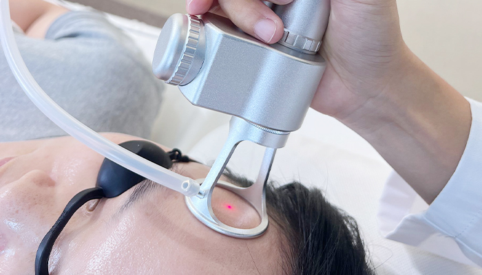 Professional CO2 Laser resurfacing procedure for skin rejuvenation
