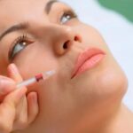 PRP Facial Treatments in Fort Lauderdale