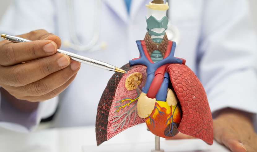 Pneumonia Treatment Market