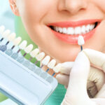 teeth whitening in Mumbai