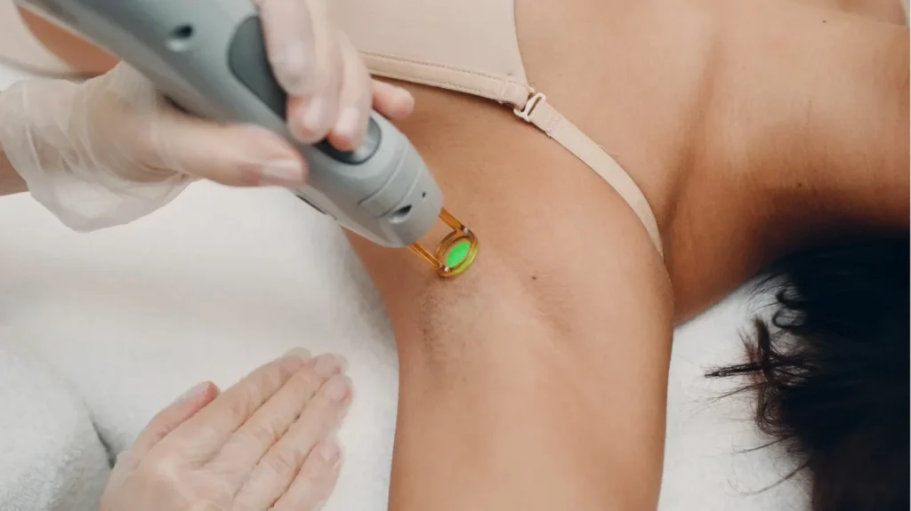 Laser Hair Removal in Pakistan: Cost, Sessions & Safety