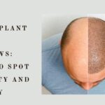 hair transplant clinic