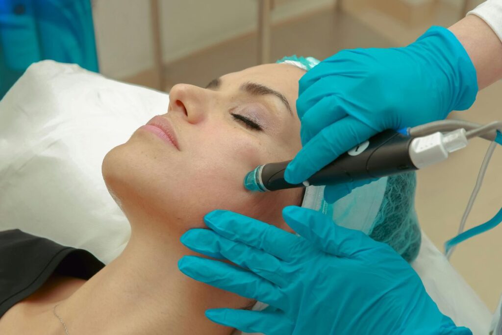 acne scar treatment - Adore skin clinic in andheri