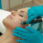 acne scar treatment - Adore skin clinic in andheri
