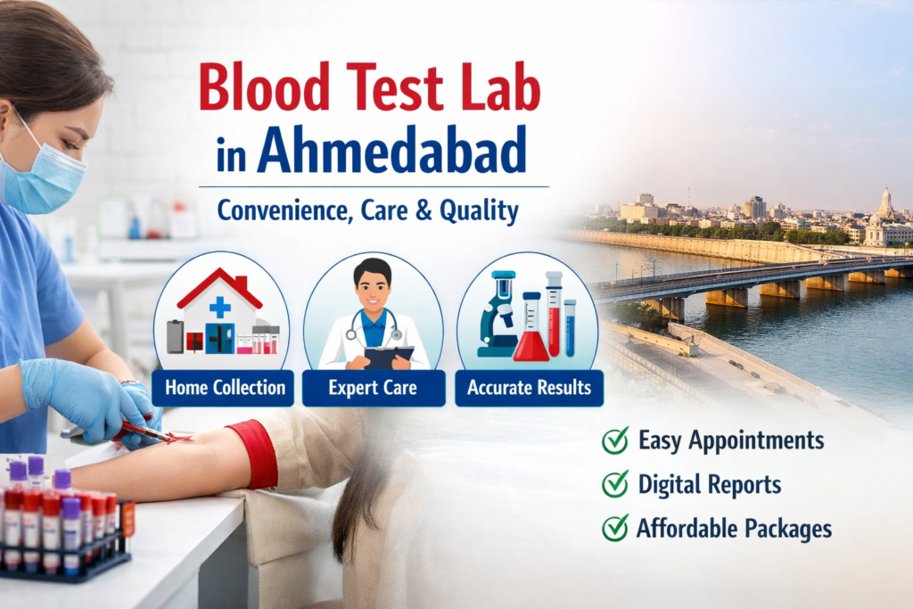 blood-test-with-home-blood-sample-collection