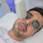 إزالة الشعر بالليزر في دبي