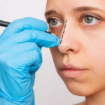 تجميل الأنف في دبي