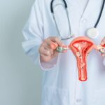 Uterine Fibroid Embolization Cost in India