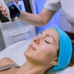 cryotherapyfacial
