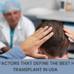 best hair transplant in usa